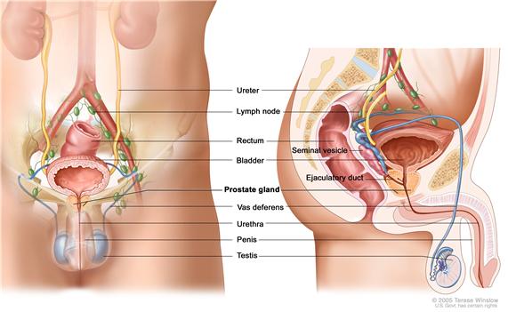 ProstateCancer